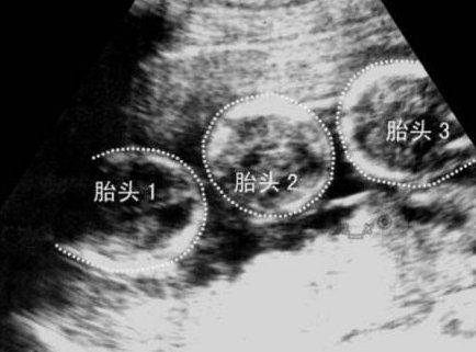 泰国试管婴儿中心靠谱之选，五大实力助孕机构推荐